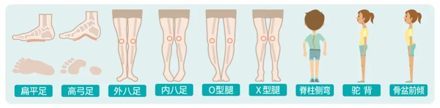 关注儿童步态，同步德国，科德曼来「哈尔滨」啦